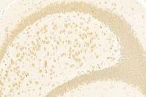 Immunohistochemistry analysis of paraffin-embedded mouse hippocampus using PPP2R2A (ABIN7075274) at dilution of 1: 2000