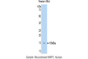 Western blot analysis of the recombinant protein. (Neuropilin 1 anticorps  (AA 27-143))