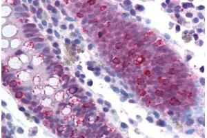 Human Colon (formalin-fixed, paraffin-embedded) stained with SF1 antibody ABIN214143 at 5 ug/ml followed by biotinylated goat anti-rabbit IgG secondary antibody ABIN481713, alkaline phosphatase-streptavidin and chromogen.