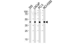 Western Blotting (WB) image for anti-Steroid 5 alpha-Reductase 3 (SRD5A3) antibody (ABIN3002292) (SRD5A3 anticorps)