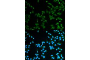 Immunofluorescence analysis of A549 cell using SPIN1 antibody. (Spindlin 1 anticorps)