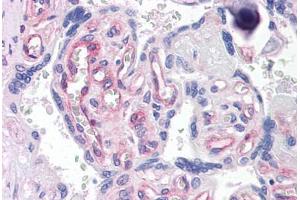 Human Placenta: Formalin-Fixed, Paraffin-Embedded (FFPE)