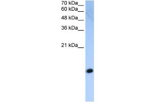 HIST2H2AC antibody used at 2. (HIST2H2AC anticorps  (Middle Region))