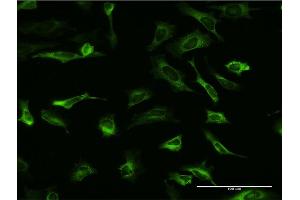 Immunofluorescence of monoclonal antibody to PCBP2 on HeLa cell. (PCBP2 anticorps  (AA 1-362))