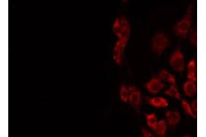 ABIN6275611 staining Hela by IF/ICC. (STMN4 anticorps  (Internal Region))