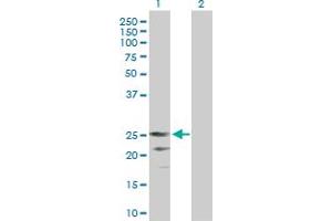 Western Blot analysis of CD70 expression in transfected 293T cell line by CD70 MaxPab polyclonal antibody. (CD70 anticorps  (AA 1-193))