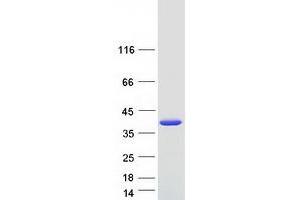 Validation with Western Blot