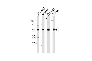 GPT Antibody (N-term ) (ABIN391679 and ABIN2841588) western blot analysis in U87-MG cell line , mouse liver ,and rat heart and liver tissue lysates (35 μg/lane). (ALT anticorps  (N-Term))