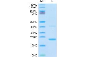 Biotinylated Mouse IL-21 on Tris-Bis PAGE under reduced condition. (IL-21 Protein (AA 18-146) (His-Avi Tag,Biotin))