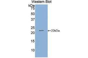 Western blot analysis of the recombinant protein. (RBP4 anticorps  (AA 19-201))