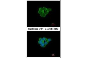 ICC/IF Image Immunofluorescence analysis of methanol-fixed A431, using Nicotinic Acetylcholine Receptor alpha 3, antibody at 1:500 dilution.