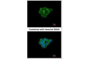 ICC/IF Image Immunofluorescence analysis of methanol-fixed A431, using Nicotinic Acetylcholine Receptor alpha 3, antibody at 1:500 dilution. (CHRNA3 anticorps  (Center))