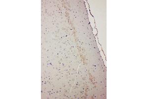 Anti-Dopamine Receptor D1 antibody, IHC(P) IHC(P): Rat Brain Tissue