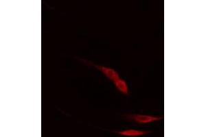 anti-Phospholipase C gamma 2 (PLCG2) (pTyr753) antibody