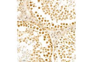 Immunohistochemistry of paraffin embedded rat testis using BPTF (ABIN7073234) at dilution of 1:1000 (400x lens) (BPTF anticorps)