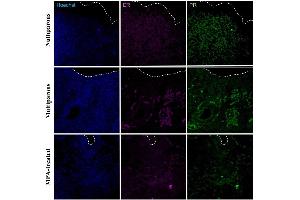 Immunohistochemical detection of progesterone receptor (PR) and estradiol receptor (ER) in the apical region of the endometrium in uteri of nulliparous, multiparous and MPA-treated dogs. (Estrogen Receptor alpha anticorps  (pTyr537) (Alexa Fluor 647))