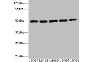 Western blot All lanes: KCNJ4 antibody at 2. (KCNJ4 anticorps  (AA 316-445))