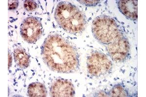 Immunohistochemical analysis of paraffin-embedded stomach tissues using MUC5AC mouse mAb with DAB staining. (MUC5AC anticorps  (AA 28-327))