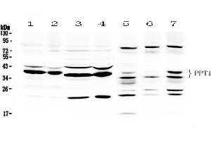 Western blot analysis of PPT1 using anti- PPT1 antibody .