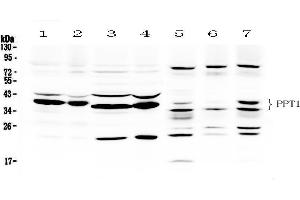 Western blot analysis of PPT1 using anti- PPT1 antibody .