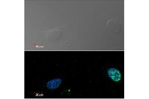 Immunocytochemistry detection of Ki-67 in U2OS cell line (human osteosarcoma) using monoclonal antibody Ki-67 (green). (Ki-67 anticorps)