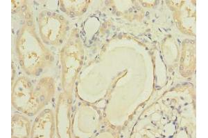 Immunohistochemistry of paraffin-embedded human kidney tissue using ABIN7150185 at dilution of 1:100 (MCM9 anticorps  (AA 1-391))