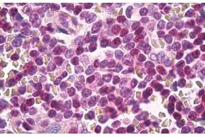 Image no. 1 for anti-CDC28 Protein Kinase Regulatory Subunit 1B (CKS1B) (C-Term) antibody (ABIN1493317) (CKS1 anticorps  (C-Term))