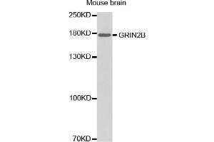 Western blot analysis of extracts of mouse brain, using GRIN2B antibody (ABIN2974534). (GRIN2B anticorps)
