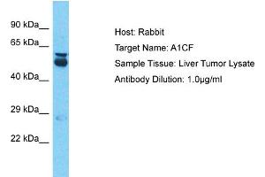 Host: Rabbit Target Name: A1CF Sample Type: Liver Tumor lysates Antibody Dilution: 1. (A1CF anticorps  (N-Term))