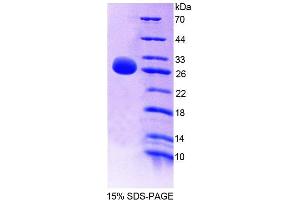 SDS-PAGE analysis of Rat GSTm4 Protein. (GSTM4 Protéine)