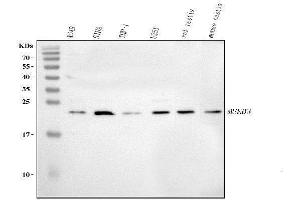 Western blot analysis of MSRB3 using anti-MSRB3 antibody (ABIN7601211).