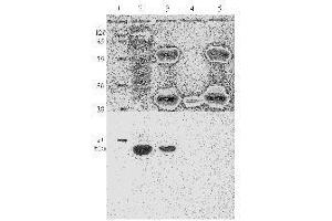 Western Blotting (WB) image for anti-Human Papilloma Virus 11 E7 (HPV-11 E7) (AA 36-70) antibody (ABIN781777) (Humain Papilloma Virus 11 E7 (HPV-11 E7) (AA 36-70) anticorps)