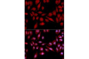 Immunofluorescence analysis of U2OS cell using PSMA2 antibody. (PSMA2 anticorps  (AA 1-234))