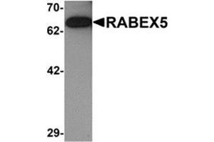 Western blot analysis of RABEX5 in rat brain tissue lysate with RABEX5 antibody at 1 μg/ml.