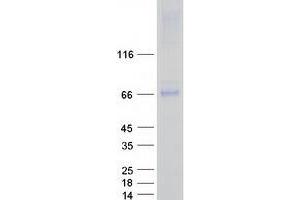 Validation with Western Blot