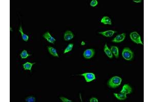 Immunofluorescent analysis of A549 cells using ABIN7156703 at dilution of 1:100 and Alexa Fluor 488-congugated AffiniPure Goat Anti-Rabbit IgG(H+L)
