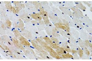 Immunohistochemistry of paraffin-embedded Rat heart using PTPN11 Polyclonal Antibody at dilution of 1:100 (40x lens). (PTPN11 anticorps)