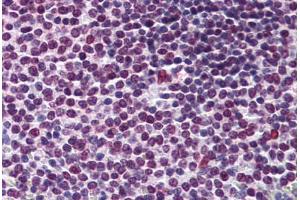 Human Spleen: Formalin-Fixed, Paraffin-Embedded (FFPE) (RCC1 anticorps  (AA 312-421))