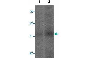 Western blot analysis of SLC39A14 in human spleen tissue lysate with SLC39A14 polyclonal antibody  at (1) 1 and (2) 2 ug/mL. (SLC39A14 anticorps  (Internal Region))
