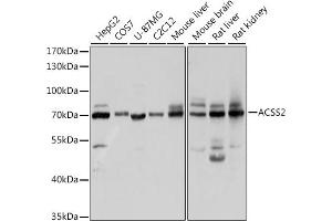 Western blot analysis of extracts of various cell lines, using ACSS2 antibody (ABIN2560918) at 1:1000 dilution. (ACSS2 anticorps)