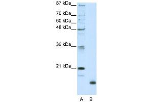 WB Suggested Anti-RPL32 Antibody Titration:  2. (RPL32 anticorps  (N-Term))