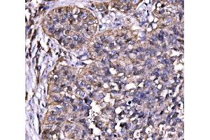 IHC analysis of Drebrin/DBN1 using anti-Drebrin/DBN1 antibody (ABIN7602638). (DBN1 anticorps  (AA 9-649))