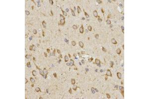 Immunohistochemistry of paraffin-embedded rat brain tissue using GRM8 antibody at dilution of 1:200 (x400 lens) (GRM8 anticorps)