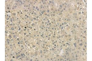 ABIN6264524 and ABIN6272977 at 1/100 staining human normal lung tissue by IHC-P.