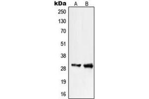 Western blot analysis of PIGX expression in COLO205 (A), WI38 (B) whole cell lysates. (PIGX anticorps  (C-Term))