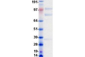 Validation with Western Blot