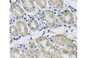 Immunohistochemistry of paraffin-embedded Human stomach using ST8SIA2 Polyclonal Antibody at dilution of 1:100 (40x lens). (ST8SIA2 anticorps)