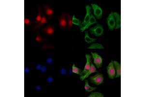 ABIN6258474 and ABIN6274426 staining Hela cells by IF/ICC. (SPIC anticorps  (Internal Region))
