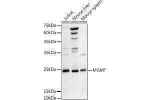 Western blot analysis of extracts of various cell lines, using MGMT antibody (ABIN3021096, ABIN3021097, ABIN3021098 and ABIN6213949) at 1:1000 dilution. (MGMT anticorps  (AA 1-207))