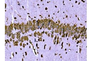 IHC analysis of BRSK1 using anti-BRSK1 antibody (ABIN7600990).